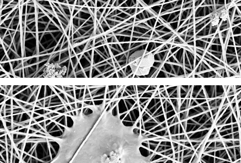 examples of anomalies in SEM images of nanofibers